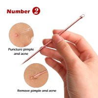Инструменты для чистки лица Lanbena/набор из 4 инструментов/от черных точек/удаление акне/от прыщей/